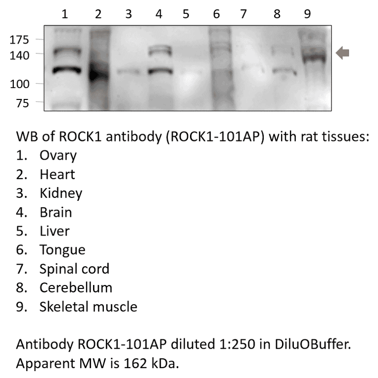 Anti-ROCK1 Antibody from FabGennix (ROCK1-101AP) - Antibodies.com