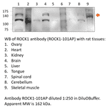 Anti-ROCK1 Antibody from FabGennix (ROCK1-101AP) - Antibodies.com