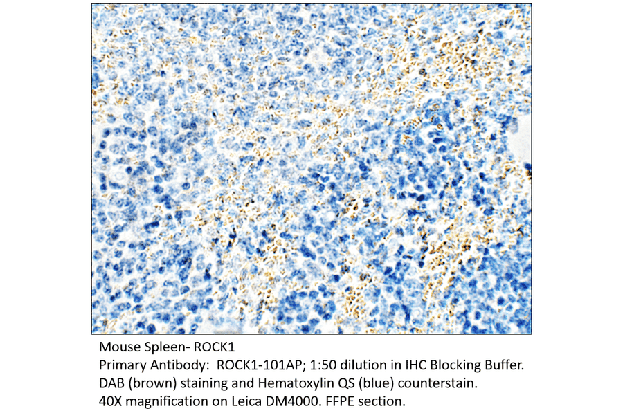Anti-ROCK1 Antibody from FabGennix (ROCK1-101AP) - Antibodies.com
