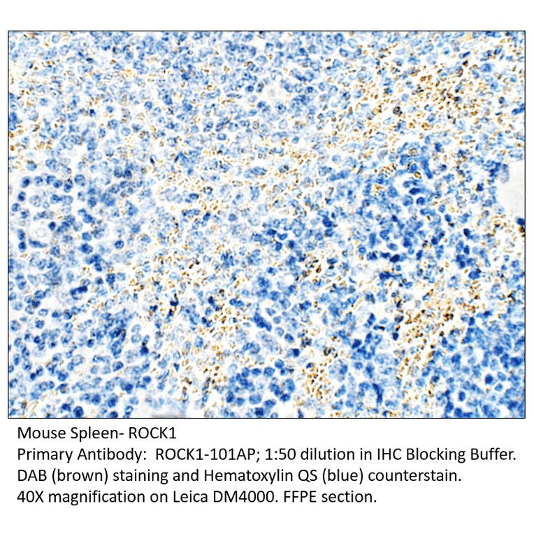 Anti-ROCK1 Antibody from FabGennix (ROCK1-101AP) - Antibodies.com