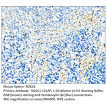 Anti-ROCK1 Antibody from FabGennix (ROCK1-101AP) - Antibodies.com