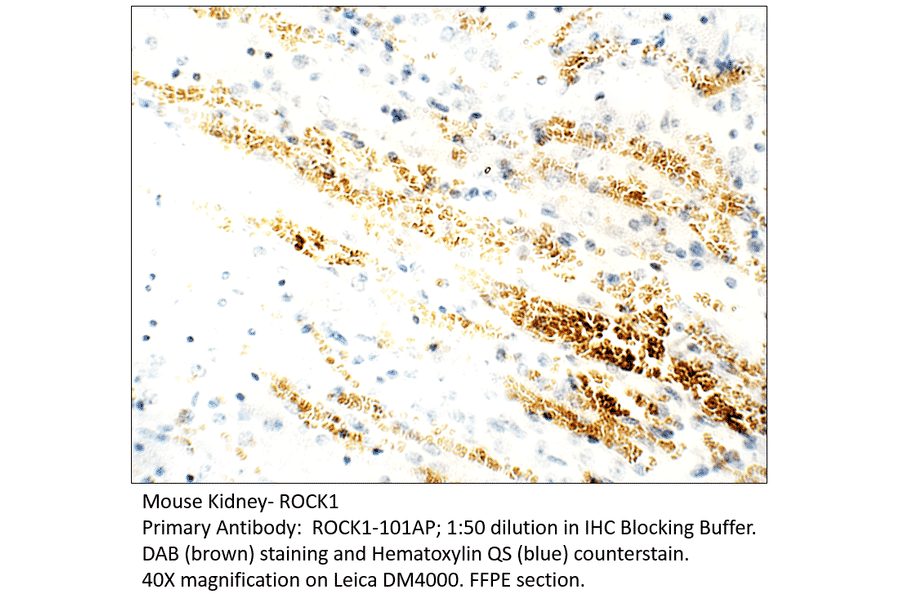 Anti-ROCK1 Antibody from FabGennix (ROCK1-101AP) - Antibodies.com