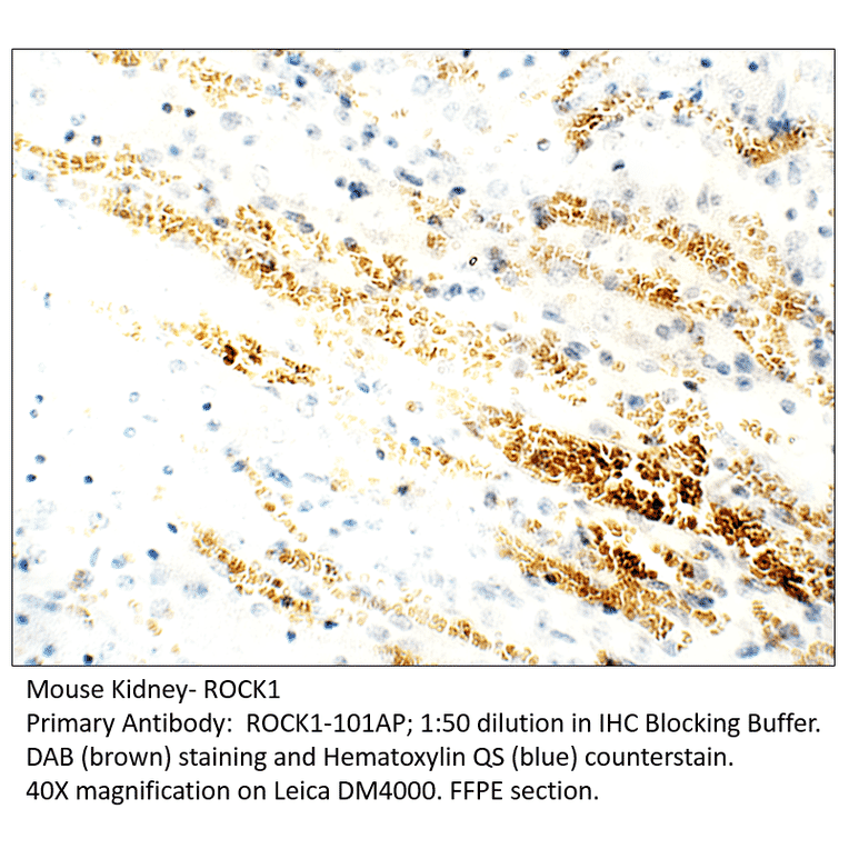 Anti-ROCK1 Antibody from FabGennix (ROCK1-101AP) - Antibodies.com