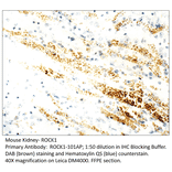 Anti-ROCK1 Antibody from FabGennix (ROCK1-101AP) - Antibodies.com