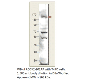 Anti-ROCK2 Antibody from FabGennix (ROCK2-201AP) - Antibodies.com