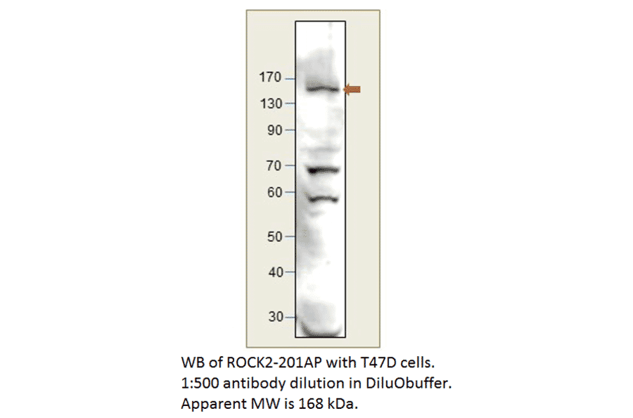 Anti-ROCK2 Antibody from FabGennix (ROCK2-201AP) - Antibodies.com