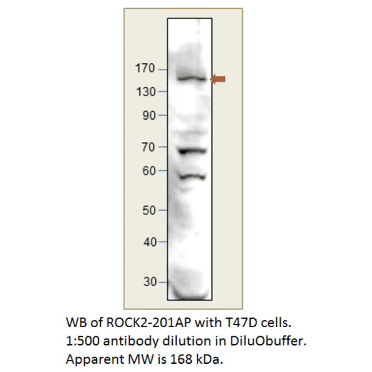 Anti-ROCK2 Antibody from FabGennix (ROCK2-201AP) - Antibodies.com