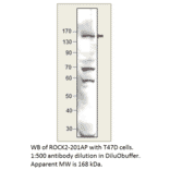 Anti-ROCK2 Antibody from FabGennix (ROCK2-201AP) - Antibodies.com