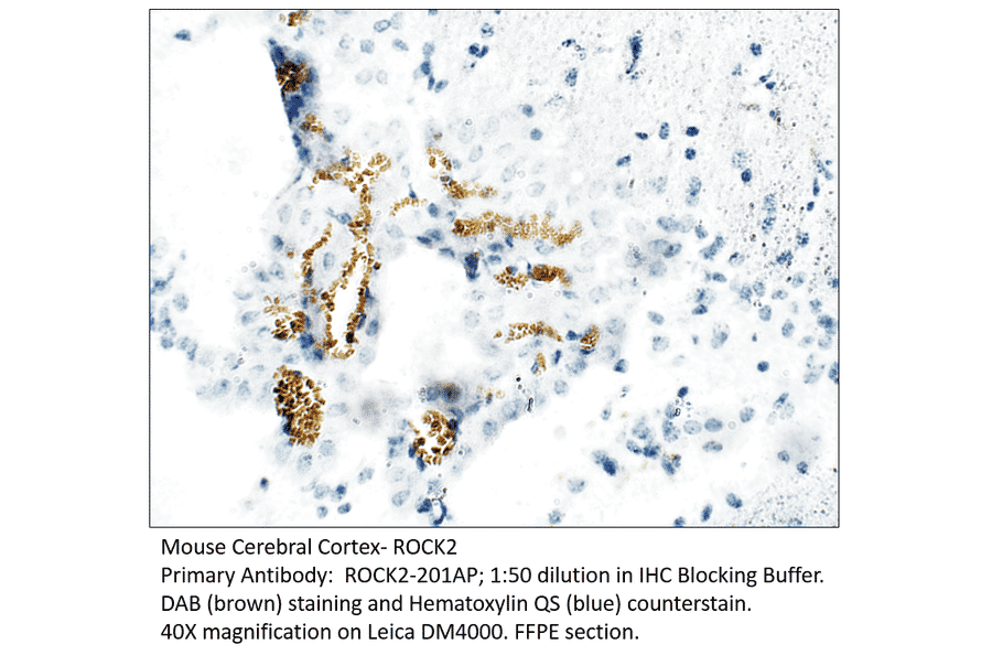 Anti-ROCK2 Antibody from FabGennix (ROCK2-201AP) - Antibodies.com