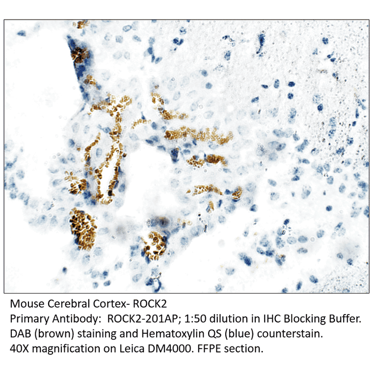 Anti-ROCK2 Antibody from FabGennix (ROCK2-201AP) - Antibodies.com