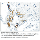 Anti-ROCK2 Antibody from FabGennix (ROCK2-201AP) - Antibodies.com