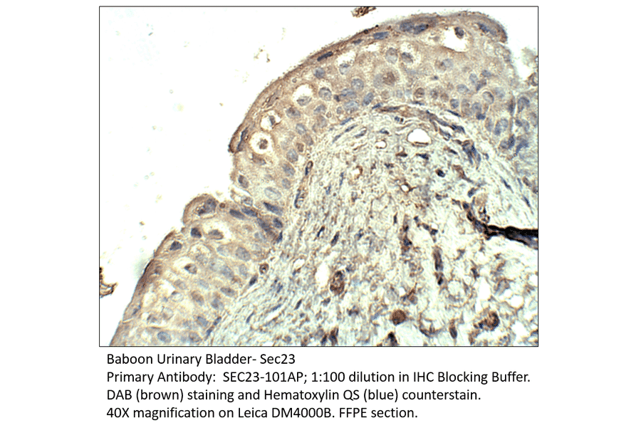 Anti-SEC23 Antibody from FabGennix (SEC23-101AP) - Antibodies.com