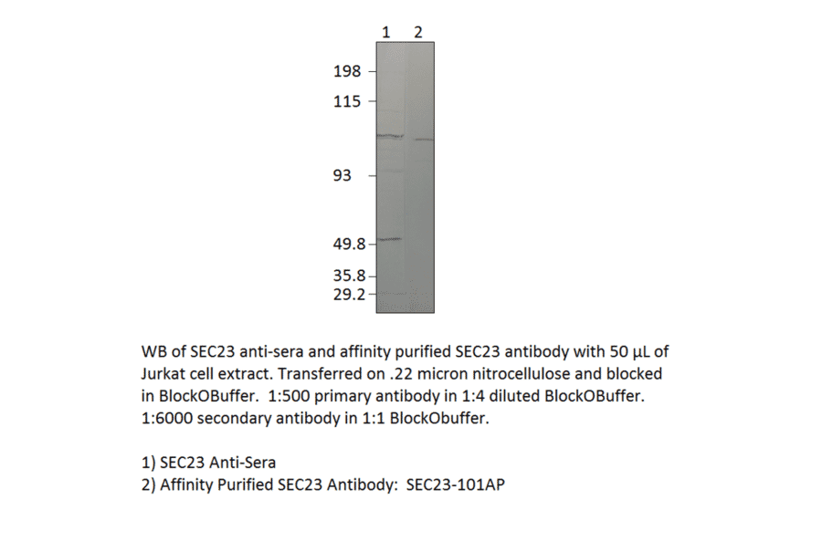 Anti-SEC23 Antibody from FabGennix (SEC23-101AP) - Antibodies.com