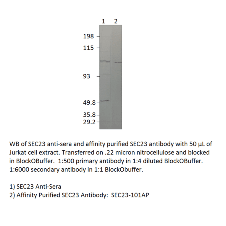 Anti-SEC23 Antibody from FabGennix (SEC23-101AP) - Antibodies.com