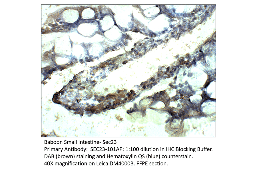 Anti-SEC23 Antibody from FabGennix (SEC23-101AP) - Antibodies.com