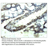 Anti-SEC23 Antibody from FabGennix (SEC23-101AP) - Antibodies.com