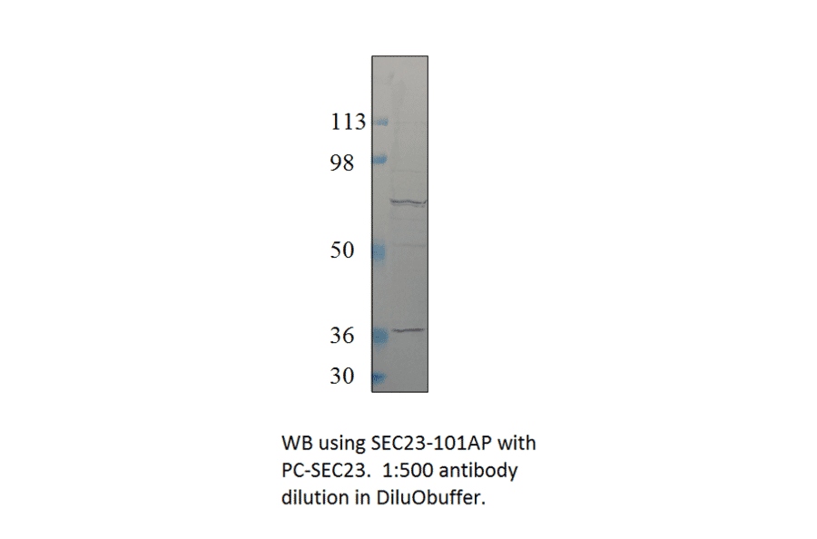 Anti-SEC23 Antibody from FabGennix (SEC23-101AP) - Antibodies.com