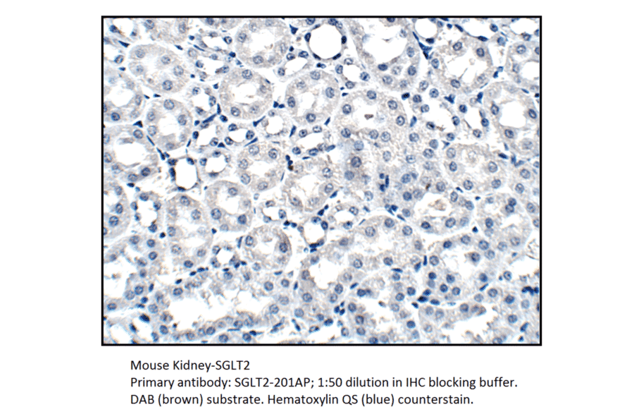 Anti-SGLT2 Antibody from FabGennix (SGLT2-201AP) - Antibodies.com
