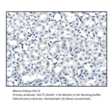 Anti-SGLT2 Antibody from FabGennix (SGLT2-201AP) - Antibodies.com