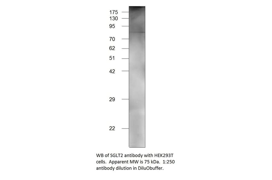 Anti-SGLT2 Antibody from FabGennix (SGLT2-201AP) - Antibodies.com