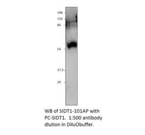 Anti-SIDT1 Antibody from FabGennix (SIDT1-101AP) - Antibodies.com