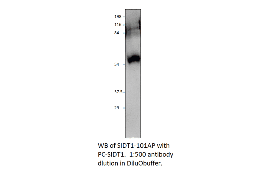 Anti-SIDT1 Antibody from FabGennix (SIDT1-101AP) - Antibodies.com