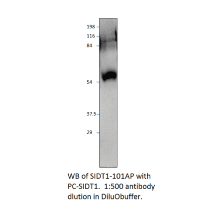 Anti-SIDT1 Antibody from FabGennix (SIDT1-101AP) - Antibodies.com