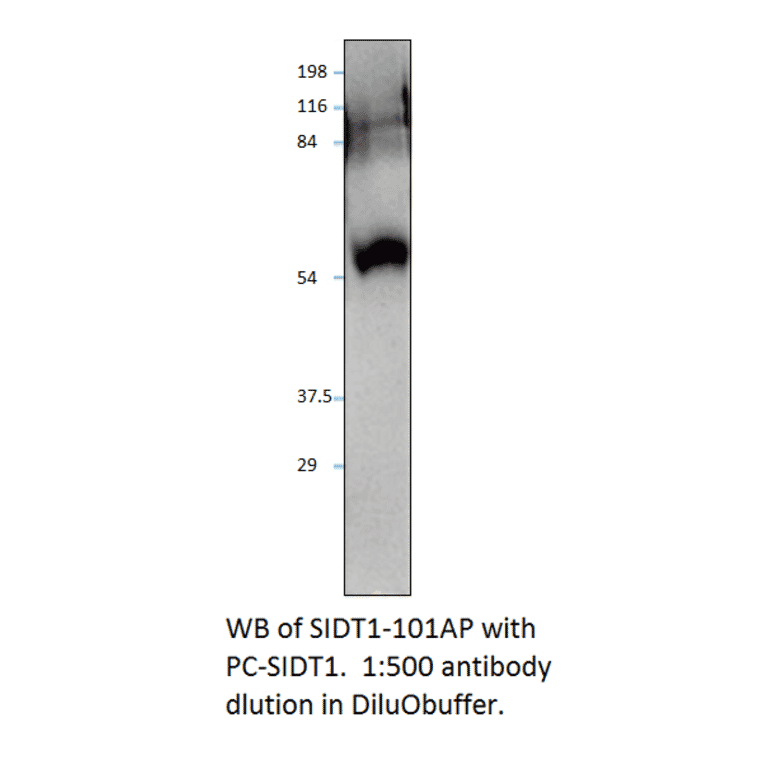 Anti-SIDT1 Antibody from FabGennix (SIDT1-101AP) - Antibodies.com
