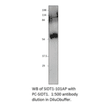 Anti-SIDT1 Antibody from FabGennix (SIDT1-101AP) - Antibodies.com