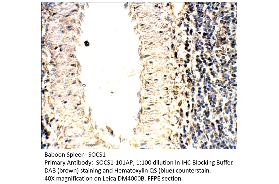 Anti-SOCS1 Antibody from FabGennix (SOCS1-101AP) - Antibodies.com