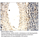 Anti-SOCS1 Antibody from FabGennix (SOCS1-101AP) - Antibodies.com