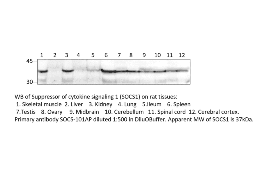Anti-SOCS1 Antibody from FabGennix (SOCS1-101AP) - Antibodies.com