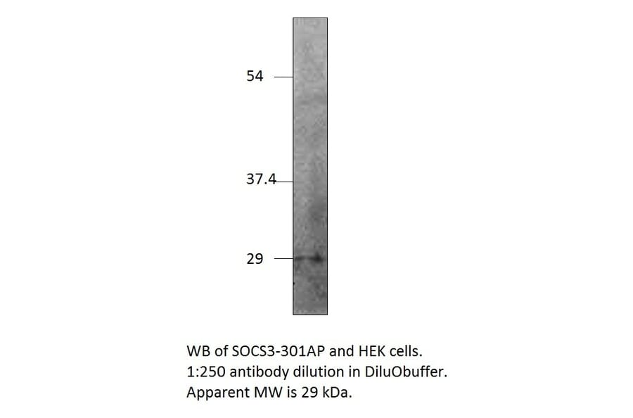 Anti-SOCS3 Antibody from FabGennix (SOCS3-301AP) - Antibodies.com