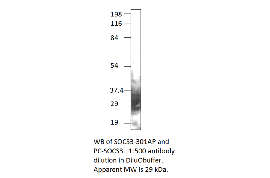 Anti-SOCS3 Antibody from FabGennix (SOCS3-301AP) - Antibodies.com
