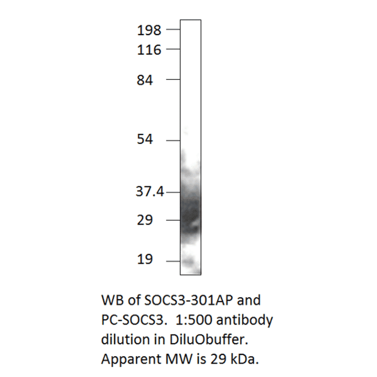 Anti-SOCS3 Antibody from FabGennix (SOCS3-301AP) - Antibodies.com