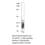 Anti-SOCS3 Antibody from FabGennix (SOCS3-301AP) - Antibodies.com