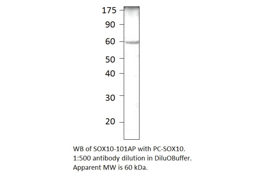 Anti-SOX10 Antibody from FabGennix (SOX10-101AP) - Antibodies.com