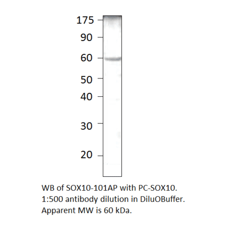 Anti-SOX10 Antibody from FabGennix (SOX10-101AP) - Antibodies.com