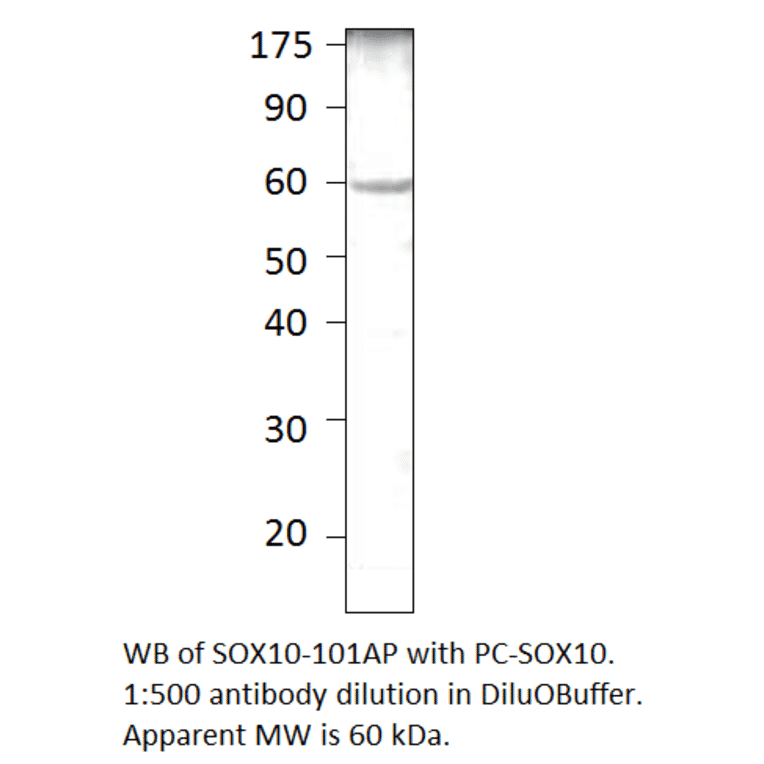 Anti-SOX10 Antibody from FabGennix (SOX10-101AP) - Antibodies.com