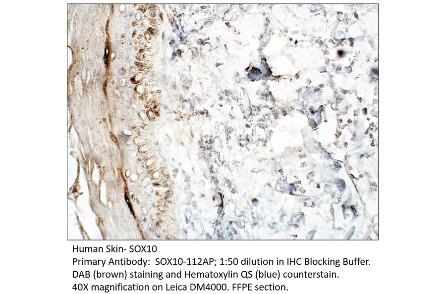 Anti-SOX10 Antibody from FabGennix (SOX10-112AP) - Antibodies.com