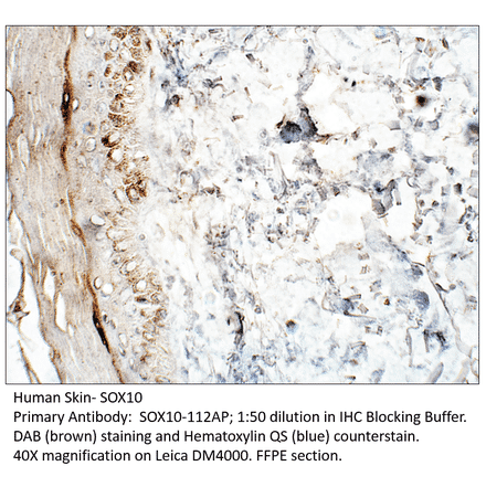 Anti-SOX10 Antibody from FabGennix (SOX10-112AP) - Antibodies.com