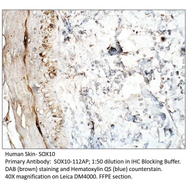 Anti-SOX10 Antibody from FabGennix (SOX10-112AP) - Antibodies.com