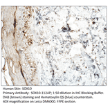 Anti-SOX10 Antibody from FabGennix (SOX10-112AP) - Antibodies.com