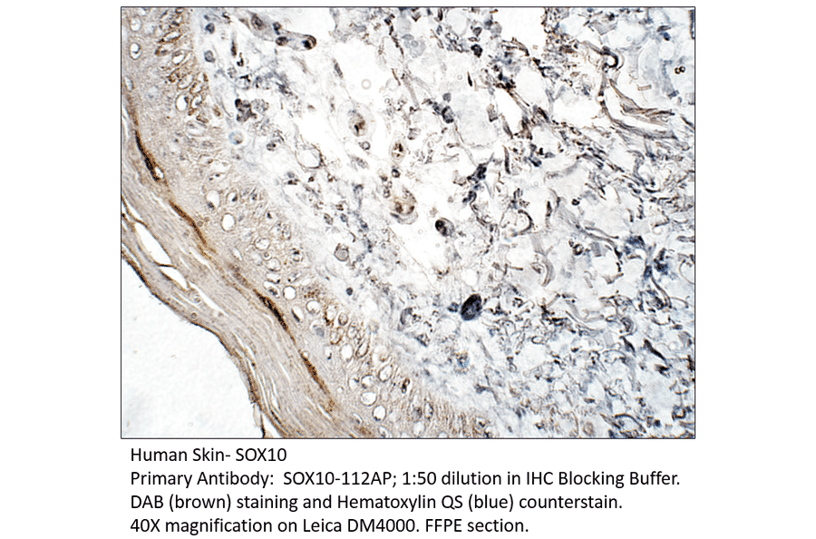 Anti-SOX10 Antibody from FabGennix (SOX10-112AP) - Antibodies.com