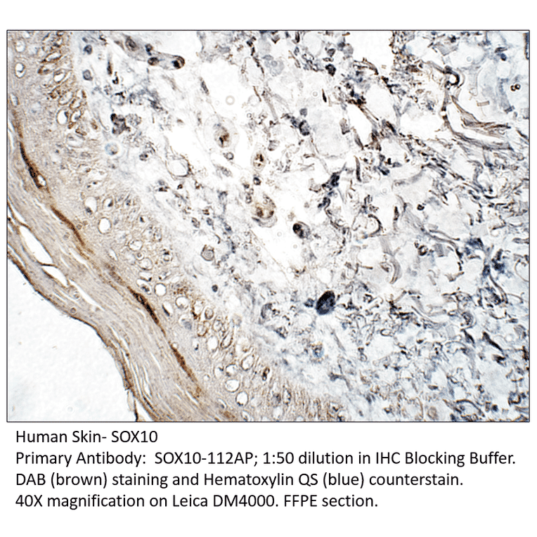 Anti-SOX10 Antibody from FabGennix (SOX10-112AP) - Antibodies.com