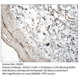 Anti-SOX10 Antibody from FabGennix (SOX10-112AP) - Antibodies.com