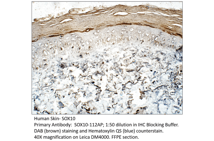 Anti-SOX10 Antibody from FabGennix (SOX10-112AP) - Antibodies.com