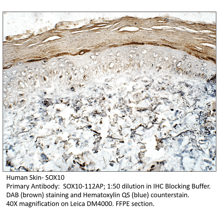 Anti-SOX10 Antibody from FabGennix (SOX10-112AP) - Antibodies.com