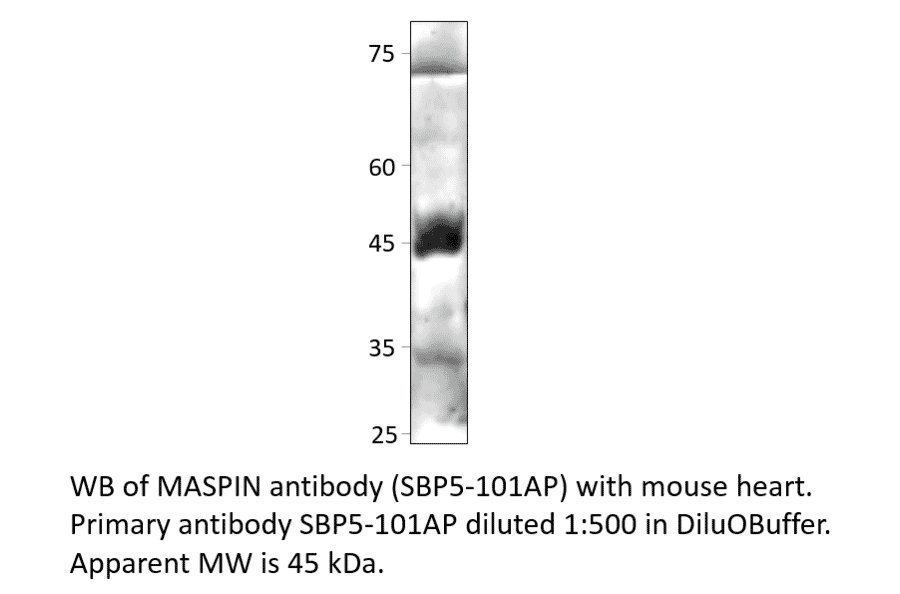 Anti-MASPIN Antibody from FabGennix (SPB5-101AP) - Antibodies.com
