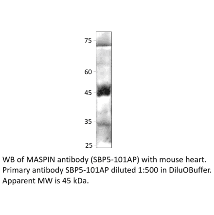 Anti-MASPIN Antibody from FabGennix (SPB5-101AP) - Antibodies.com